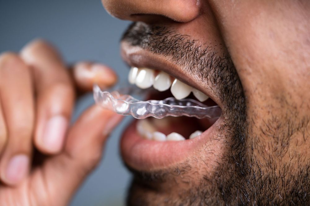 A removable retainer in a case, with a fixed retainer wire behind the teeth.