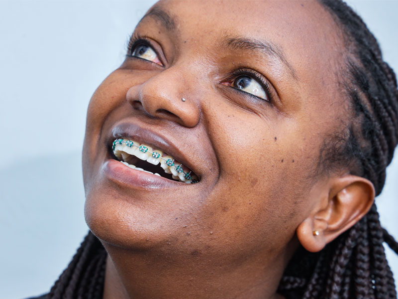 Braces in Rwanda: Types, Indications, Insurance Coverage, Treatment Time and Results