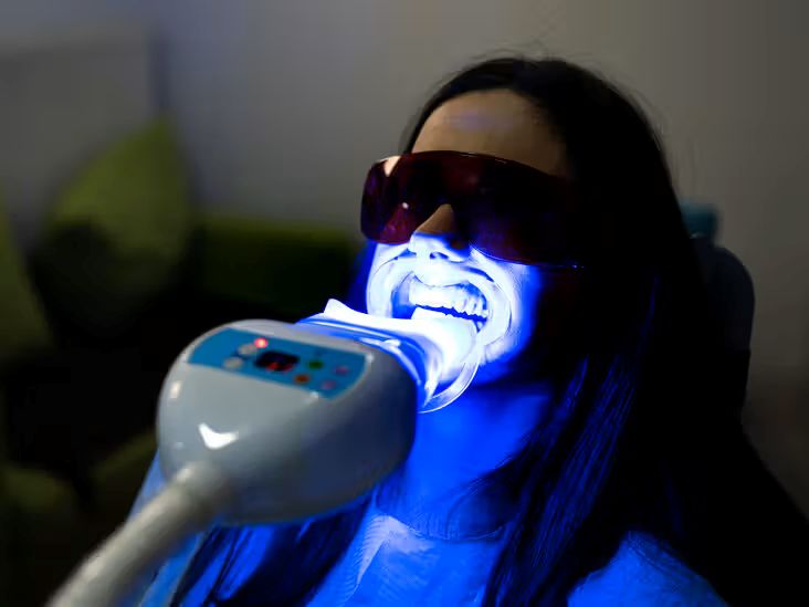 Teeth Whitening: What Works, What's Safe and What to Avoid