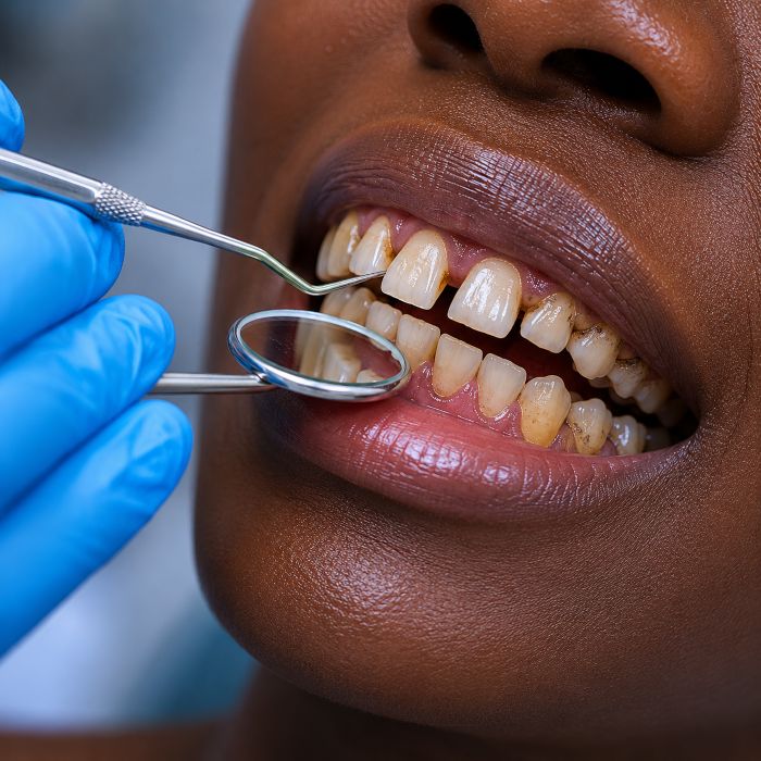 Dental examination